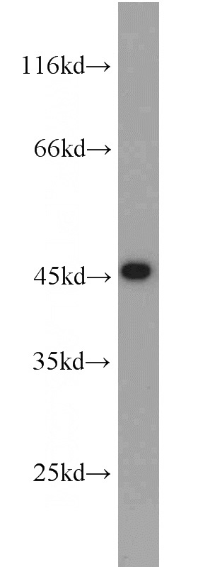 Jurkat cells were subjected to SDS PAGE followed by western blot with Catalog No:116468(UBA5 antibody) at dilution of 1:1000