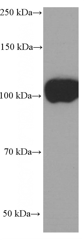 Jurkat cells were subjected to SDS PAGE followed by western blot with Catalog No:107135(SPN Antibody) at dilution of 1:1000
