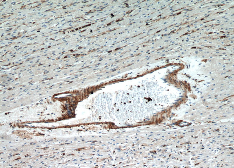 Immunohistochemical of paraffin-embedded human heart using Catalog No:109427(CNN2 antibody) at dilution of 1:50 (under 10x lens)