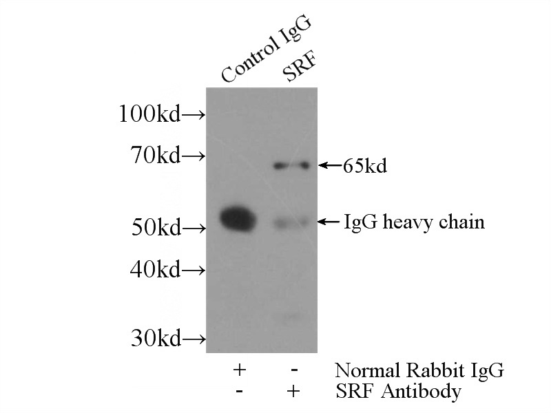 IP Result of anti-SRF (IP:Catalog No:115583, 3ug; Detection:Catalog No:115583 1:1000) with HeLa cells lysate 3000ug.