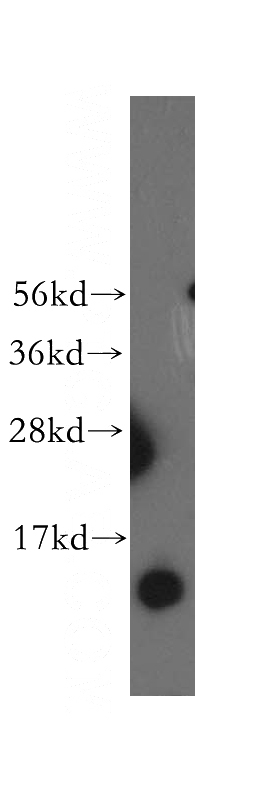 human heart tissue were subjected to SDS PAGE followed by western blot with Catalog No:113073(NDUFB3 antibody) at dilution of 1:500