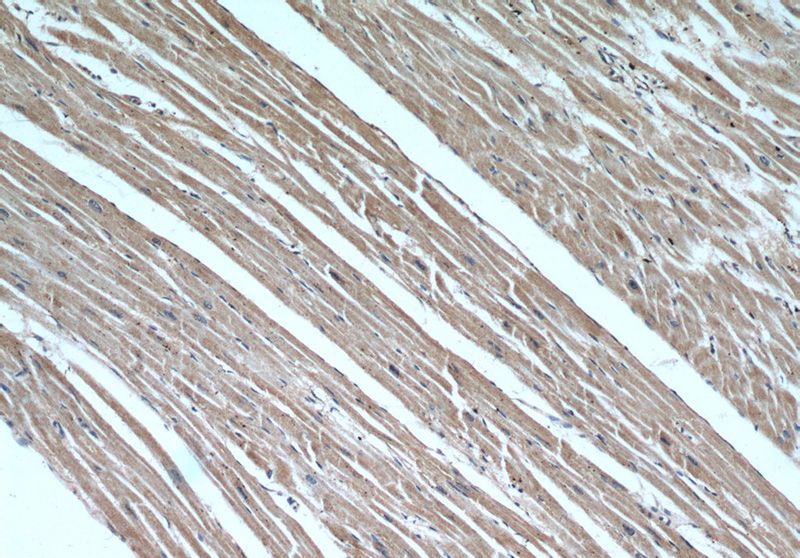 Immunohistochemical of paraffin-embedded human heart using Catalog No:117087(B3GALT2 antibody) at dilution of 1:50 (under 10x lens)