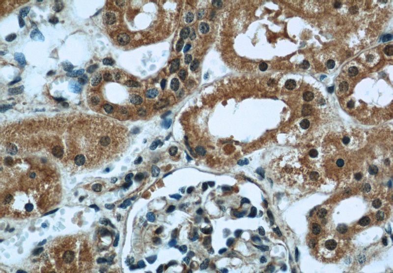 Immunohistochemical of paraffin-embedded human kidney using Catalog No:111846(INPP5K antibody) at dilution of 1:50 (under 40x lens)