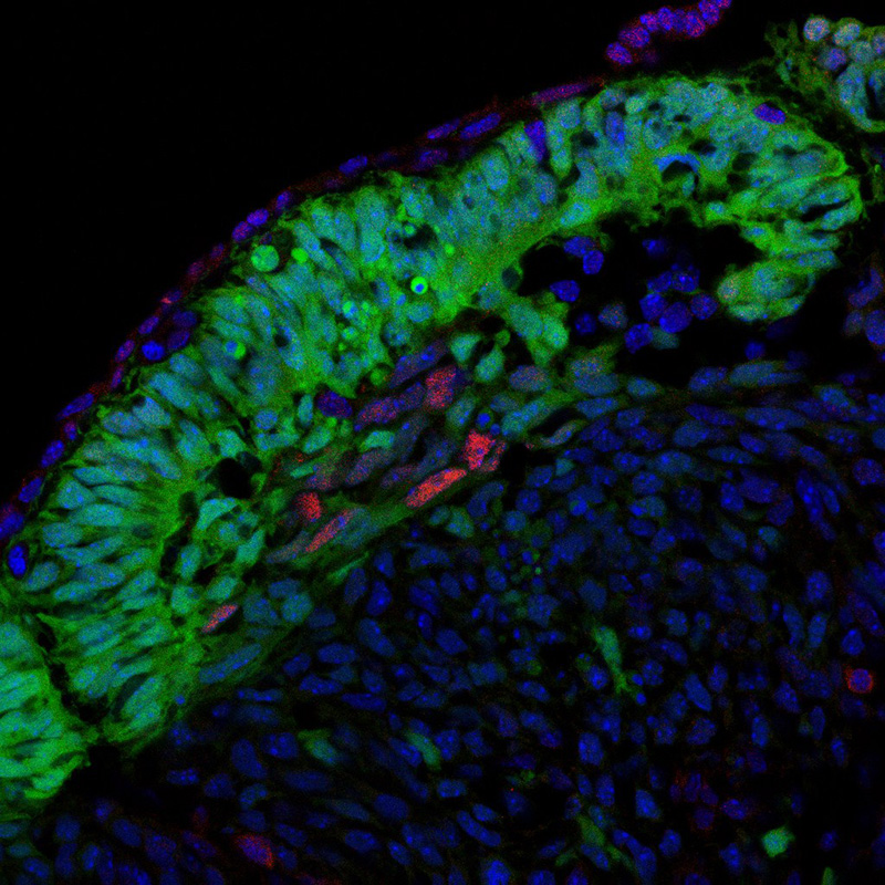 IF result of anti-p21 (CDKN1A, Catalog No:113540) in the myotome of a somite at E11.5 by Dr. Zalc A. and Dr. Relaix F. (Red = p21; Green=Pax3 from a GFP reporter; Bleu=DAPI)
