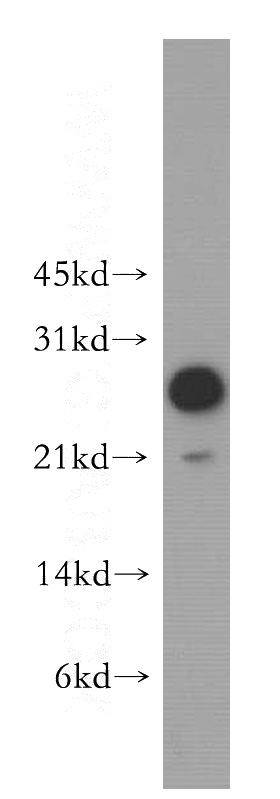 Jurkat cells were subjected to SDS PAGE followed by western blot with Catalog No:112719(MOBKL1A antibody) at dilution of 1:500
