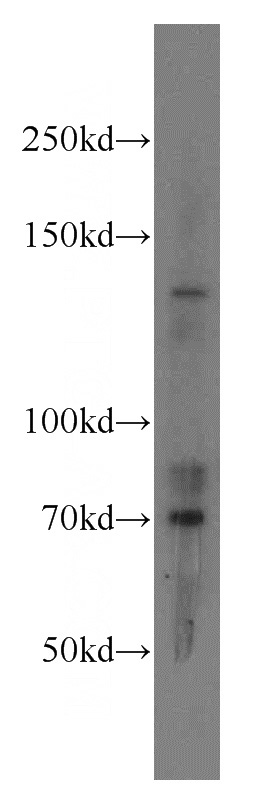 HEK-293 cells were subjected to SDS PAGE followed by western blot with Catalog No:114804(RPGRIP1 antibody) at dilution of 1:400