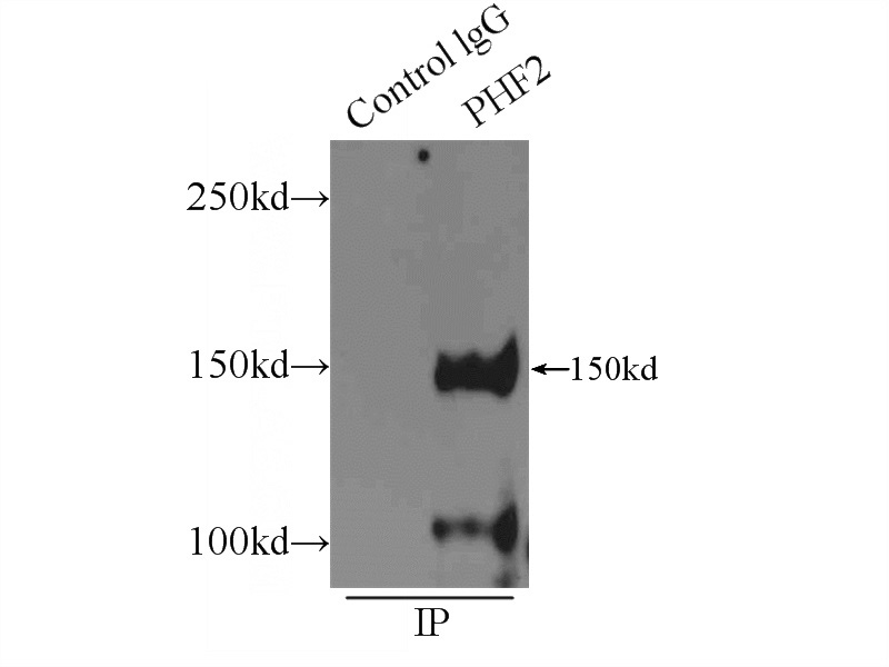 IP Result of anti-PHF2 (IP:Catalog No:113811, 4ug; Detection:Catalog No:113811 1:500) with HeLa cells lysate 1800ug.