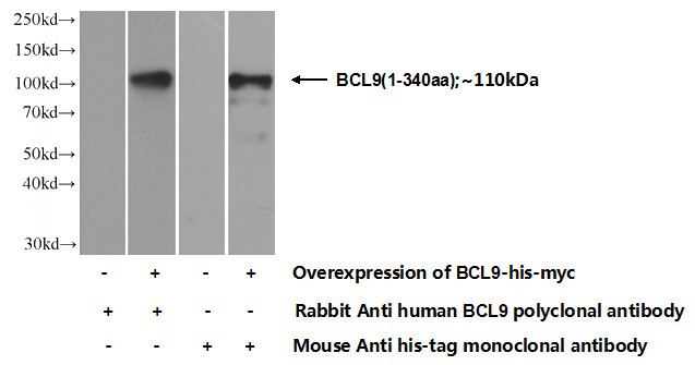 Transfected HEK-293 cells were subjected to SDS PAGE followed by western blot with Catalog No:117104(BCL9 Antibody) at dilution of 1:1000