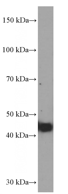 pig brain tissue were subjected to SDS PAGE followed by western blot with Catalog No:107284(FUT9 Antibody) at dilution of 1:1000