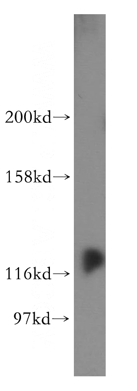 HeLa cells were subjected to SDS PAGE followed by western blot with Catalog No:109823(DDX24 antibody) at dilution of 1:300