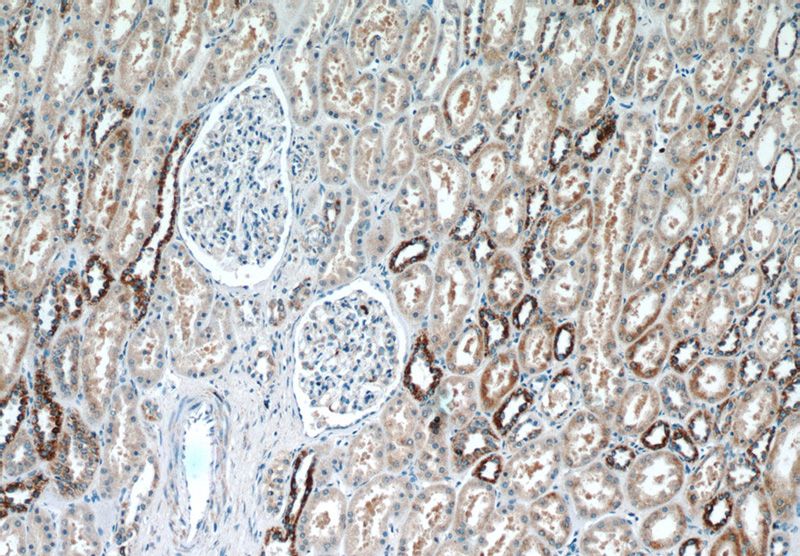 Immunohistochemistry of paraffin-embedded human kidney tissue slide using Catalog No:111999(KIF12 Antibody) at dilution of 1:50 (under 10x lens)