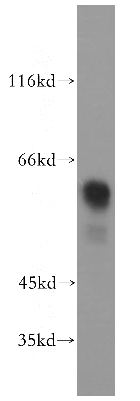 SH-SY5Y cells were subjected to SDS PAGE followed by western blot with Catalog No:109573(DPYSL3 antibody) at dilution of 1:800