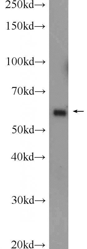 mouse testis tissue were subjected to SDS PAGE followed by western blot with Catalog No:112088(KLHL10 Antibody) at dilution of 1:1000