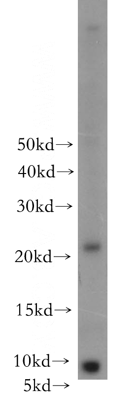 mouse lung tissue were subjected to SDS PAGE followed by western blot with Catalog No:109312(CIB4 antibody) at dilution of 1:100