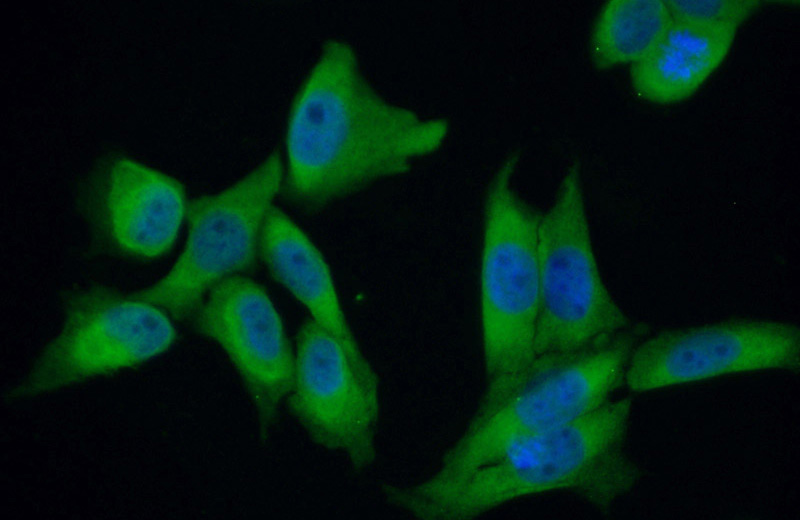Immunofluorescent analysis of (10% Formaldehyde) fixed HeLa cells using Catalog No:116925(ZC3H15 Antibody) at dilution of 1:50 and Alexa Fluor 488-congugated AffiniPure Goat Anti-Rabbit IgG(H+L)