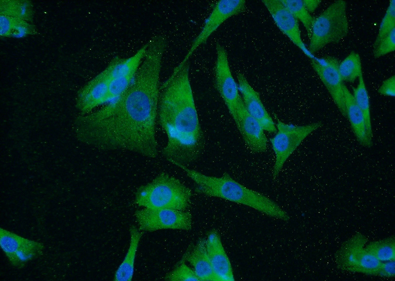 Immunofluorescent analysis of A375 cells using Catalog No:116464(UACA Antibody) at dilution of 1:50 and Alexa Fluor 488-congugated AffiniPure Goat Anti-Rabbit IgG(H+L)