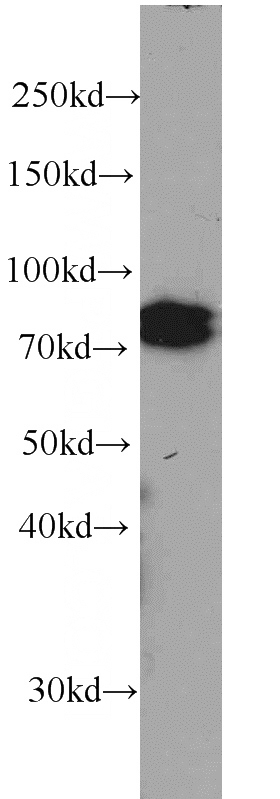 HeLa cells were subjected to SDS PAGE followed by western blot with Catalog No:107182(CUL4A antibody) at dilution of 1:500
