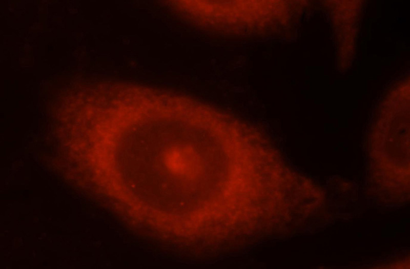 Immunofluorescent analysis of Hela cells, using NCK1 antibody Catalog No:113036 at 1:25 dilution and Rhodamine-labeled goat anti-rabbit IgG (red).