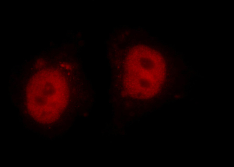 Immunofluorescent analysis of HepG2 cells using Catalog No:107432(MTA2 Antibody) at dilution of 1:50 and Rhodamine-Goat anti-Mouse IgG