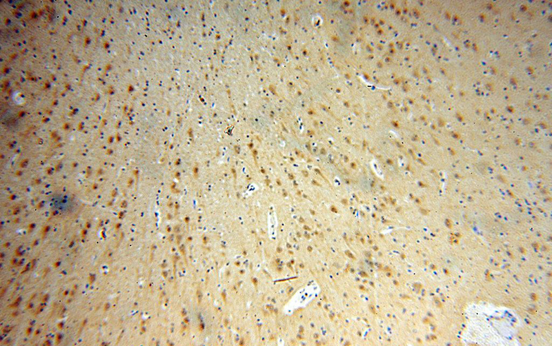 Immunohistochemical of paraffin-embedded human brain using Catalog No:114317(PTPN18 antibody) at dilution of 1:100 (under 10x lens)