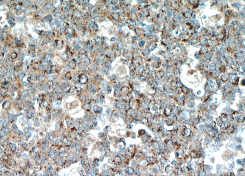 Immunohistochemical of paraffin-embedded human tonsil using Catalog No:110550(FBXO22 antibody) at dilution of 1:50 (under 40x lens)