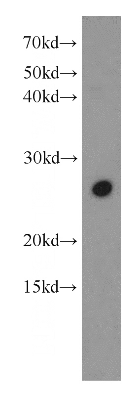 HEK-293 cells were subjected to SDS PAGE followed by western blot with Catalog No:115154(SFRS9 antibody) at dilution of 1:1000