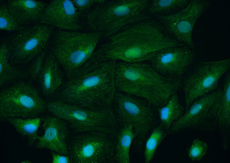 Immunofluorescent analysis of A549 cells using Catalog No:109600(CSNK1A1 Antibody) at dilution of 1:25 and Alexa Fluor 488-congugated AffiniPure Goat Anti-Rabbit IgG(H+L)