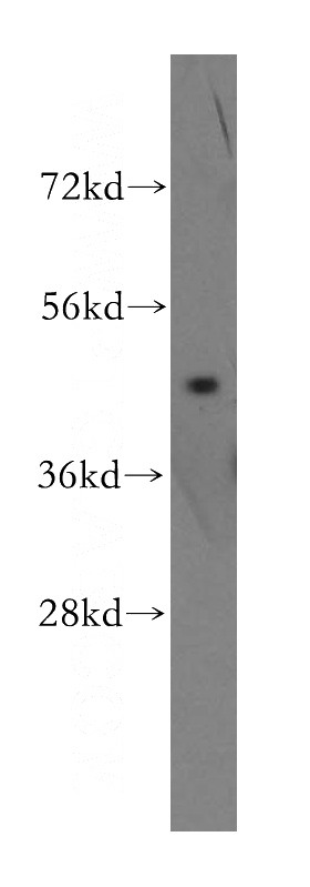 MCF7 cells were subjected to SDS PAGE followed by western blot with Catalog No:110201(EIF4A2 antibody) at dilution of 1:500