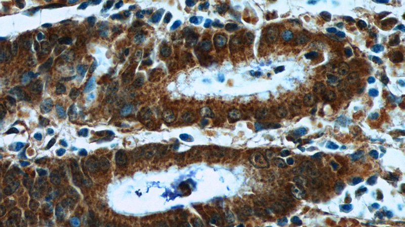 Immunohistochemistry of paraffin-embedded human stomach tissue slide using Catalog No:115093(SCT Antibody) at dilution of 1:50 (under 40x lens)