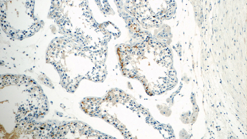 Immunohistochemistry of paraffin-embedded human testis tissue slide using Catalog No:112506(MBIP Antibody) at dilution of 1:50 (under 10x lens)