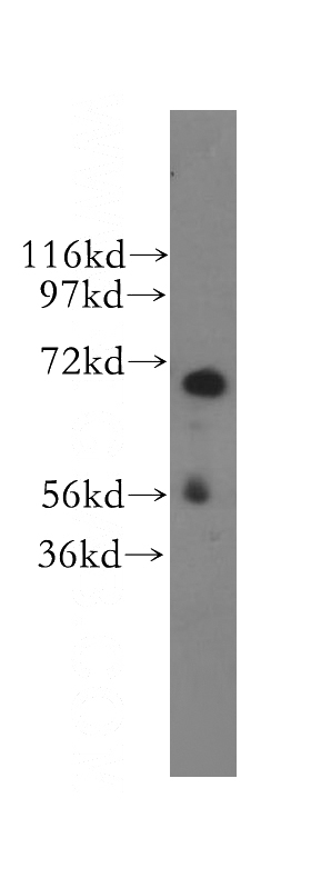 human kidney tissue were subjected to SDS PAGE followed by western blot with Catalog No:115594(SRP68 antibody) at dilution of 1:400