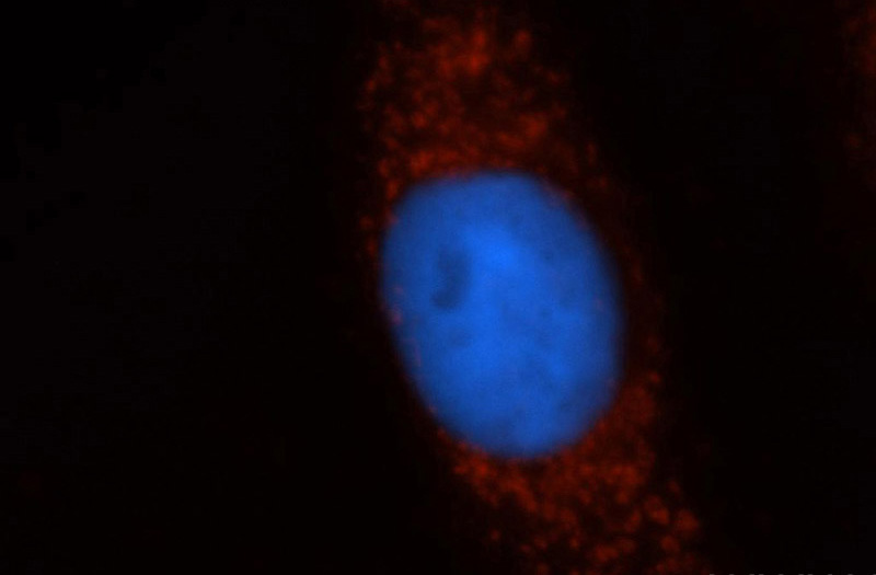 Immunofluorescent analysis of Hela cells, using NDUFS1 antibody Catalog No:113081 at 1:50 dilution and Rhodamine-labeled goat anti-rabbit IgG (red). Blue pseudocolor = DAPI (fluorescent DNA dye).