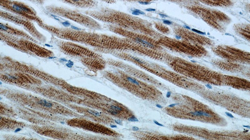Immunohistochemical of paraffin-embedded human heart using Catalog No:112166 (LC3B-Specific antibody) at dilution of 1:100 (under 40x lens).