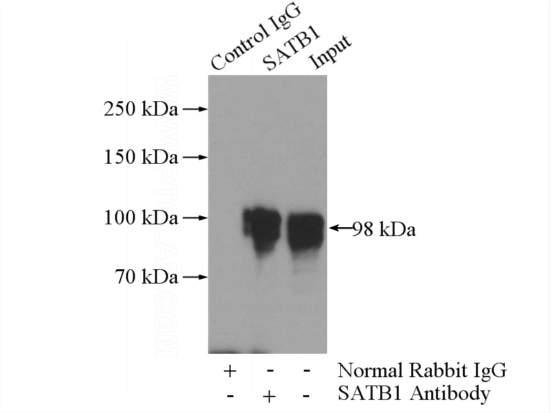 IP Result of anti-SATB1 (IP:Catalog No:114977, 4ug; Detection:Catalog No:114977 1:500) with HEK-293 cells lysate 2000ug.