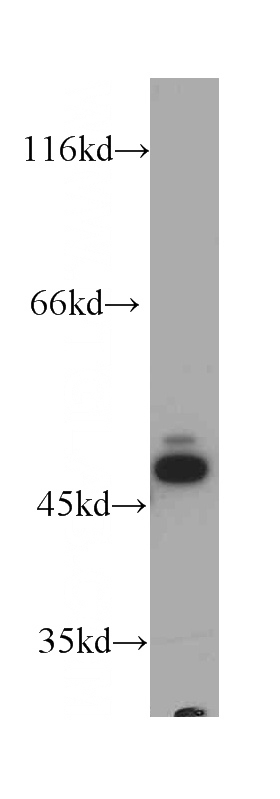 HeLa cells were subjected to SDS PAGE followed by western blot with Catalog No:107645(TRIP6 antibody) at dilution of 1:1000