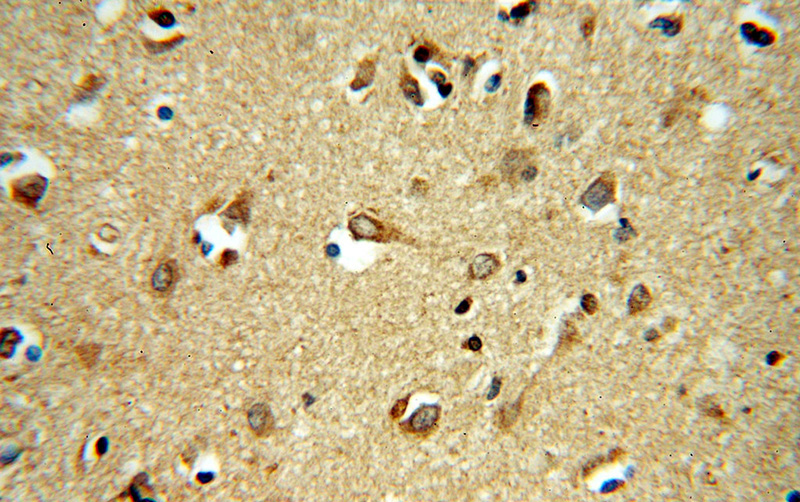 Immunohistochemical of paraffin-embedded human brain using Catalog No:114284(PRUNE2 antibody) at dilution of 1:50 (under 40x lens)