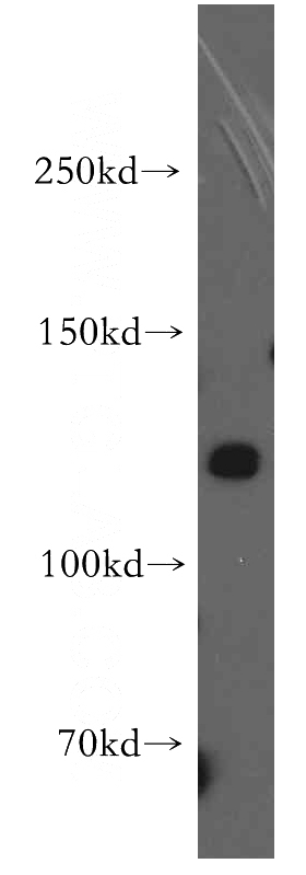 SH-SY5Y cells were subjected to SDS PAGE followed by western blot with Catalog No:116404(TRPA1 antibody) at dilution of 1:500