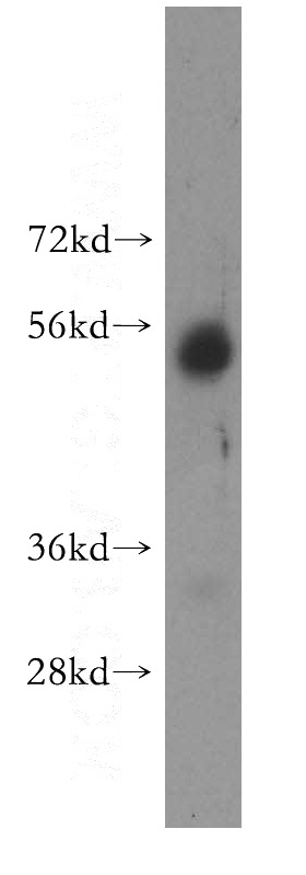 K-562 cells were subjected to SDS PAGE followed by western blot with Catalog No:113835(PISD antibody) at dilution of 1:300