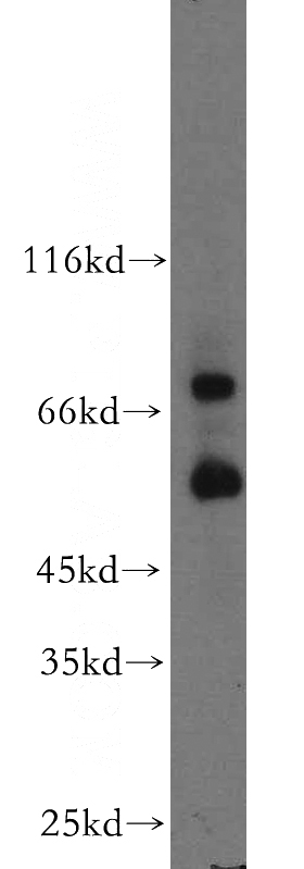 MCF7 cells were subjected to SDS PAGE followed by western blot with Catalog No:112700(MMP2 antibody) at dilution of 1:500