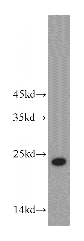 L02 cells were subjected to SDS PAGE followed by western blot with Catalog No:107812(ABHD14B antibody) at dilution of 1:400