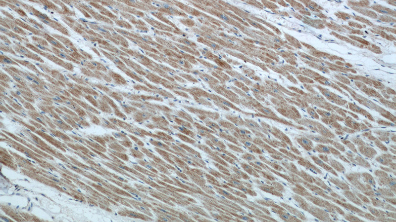 Immunohistochemical of paraffin-embedded human heart using Catalog No:111773(IL1RAPL1 antibody) at dilution of 1:50 (under 10x lens)