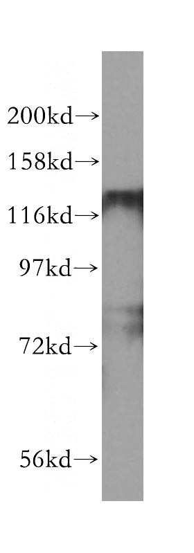 human brain tissue were subjected to SDS PAGE followed by western blot with Catalog No:111379(HDAC5-specific antibody) at dilution of 1:300