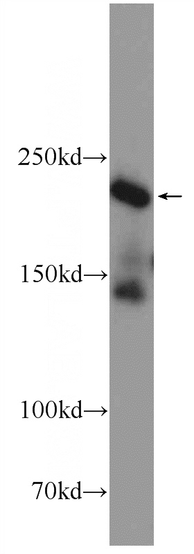 HeLa cells were subjected to SDS PAGE followed by western blot with Catalog No:114693(REST Antibody) at dilution of 1:1500