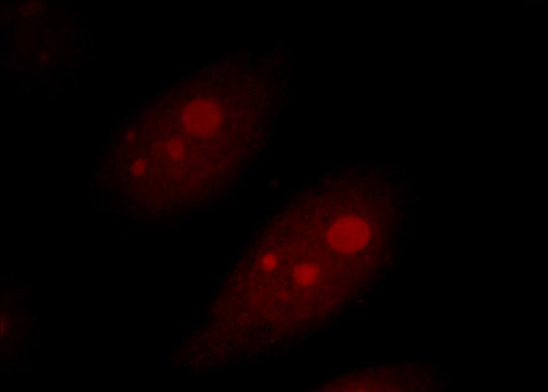 Immunofluorescent analysis of Hela cells, using AATF antibody Catalog No:107678 at 1:25 dilution and Rhodamine-labeled goat anti-rabbit IgG (red).