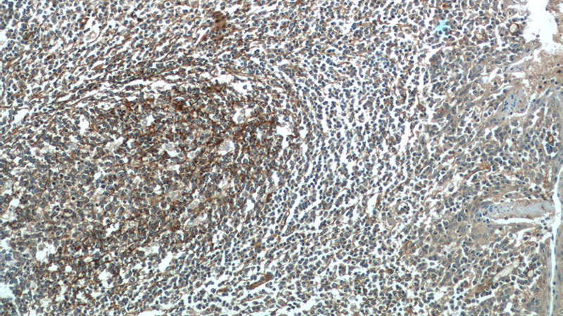 Immunohistochemical of paraffin-embedded human tonsillitis using Catalog No:109140(CD81 antibody) at dilution of 1:100 (under 10x lens)