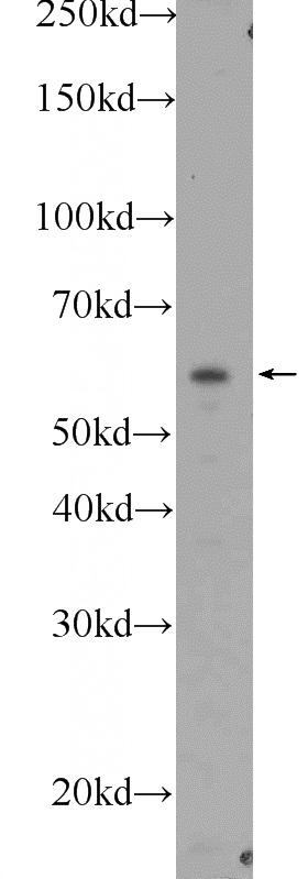 mouse kidney tissue were subjected to SDS PAGE followed by western blot with Catalog No:108367(BBS1 Antibody) at dilution of 1:600