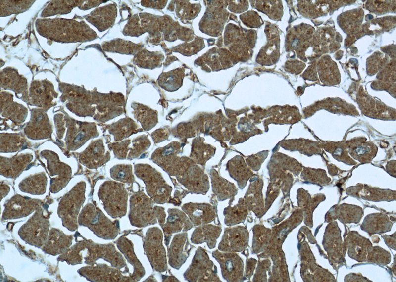 Immunohistochemistry of paraffin-embedded human heart tissue slide using Catalog No:110554(FBXO41 Antibody) at dilution of 1:50 (under 40x lens)