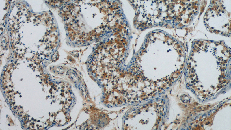 Immunohistochemistry of paraffin-embedded human testis tissue slide using Catalog No:108239(ARCN1 Antibody) at dilution of 1:50 (under 10x lens)