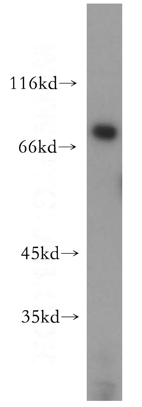 PC-3 cells were subjected to SDS PAGE followed by western blot with Catalog No:115736(STRBP antibody) at dilution of 1:500