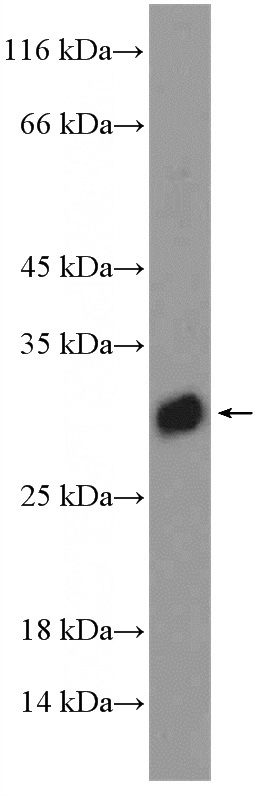 mouse lung tissue were subjected to SDS PAGE followed by western blot with Catalog No:109943(DIO1 Antibody) at dilution of 1:1000